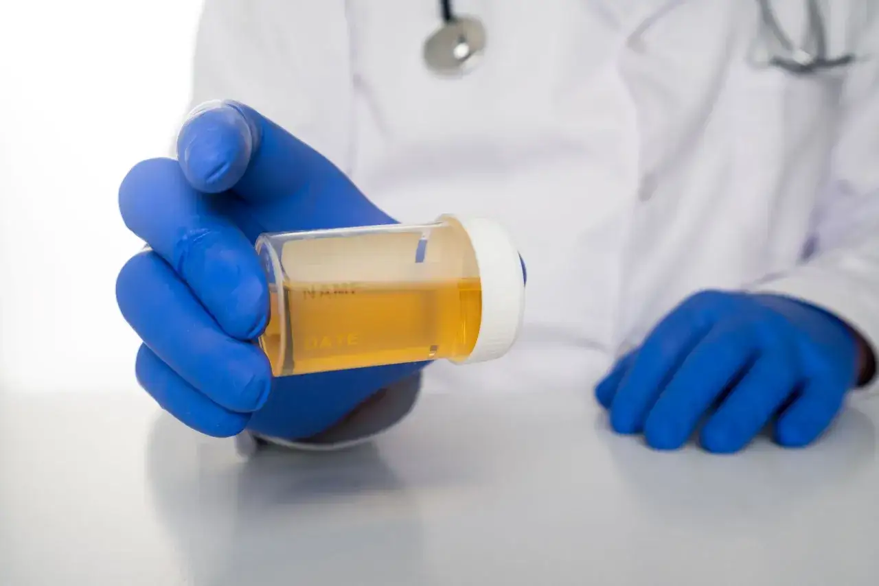 Lekarz w niebieskich rękawiczkach trzyma pojemnik z próbką moczu, kluczową w diagnostyce chorób nerek.
