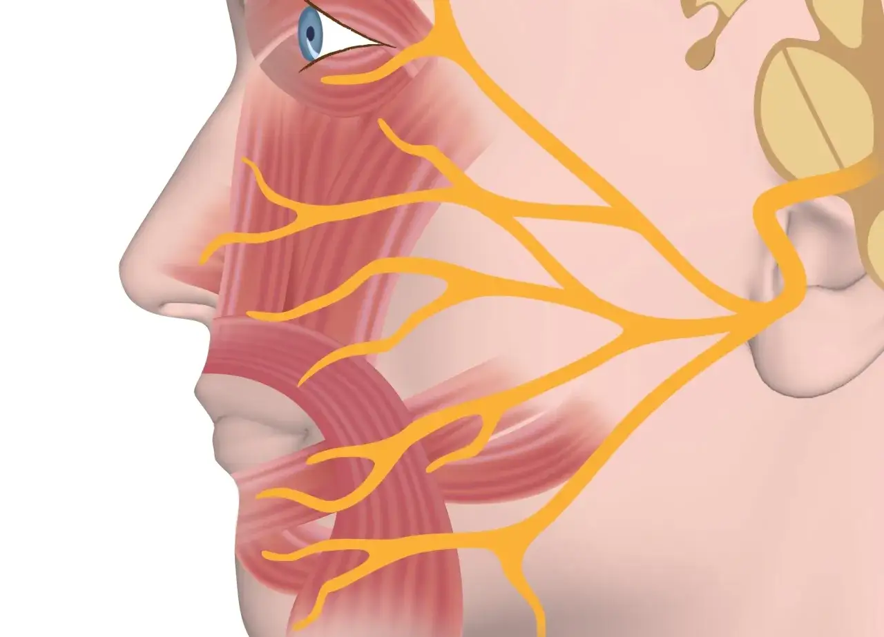 Anatomical illustration showing the trigeminal nerve branches in the face, highlighting areas affected by neuralgia nerwu trójdzielnego.