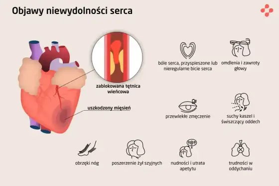 Kaszel od serca - jak go rozpoznać i kiedy iść do lekarza