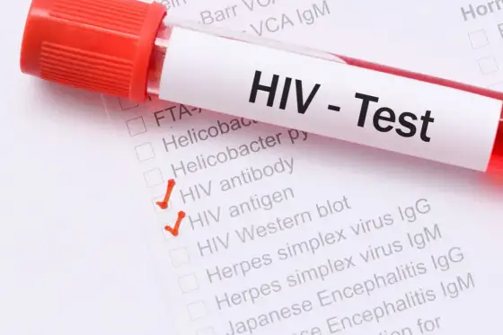 Objawy HIV u kobiet - co łatwo pomylić i kiedy zrobić test