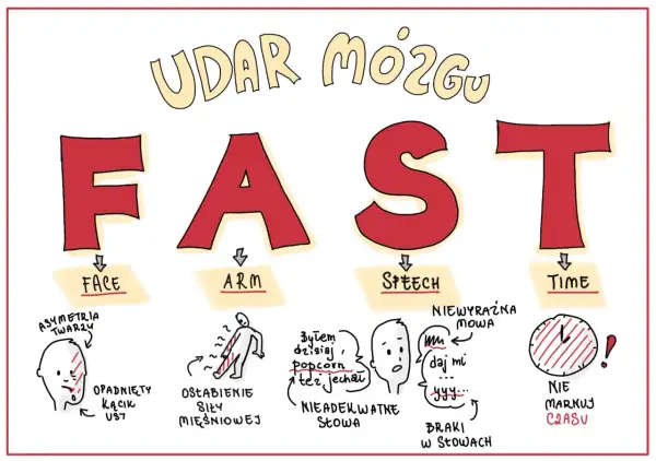 FAST - objawy udaru mózgu u dzieci: opadnięta twarz, osłabienie ręki, niewyraźna mowa, brak czasu.